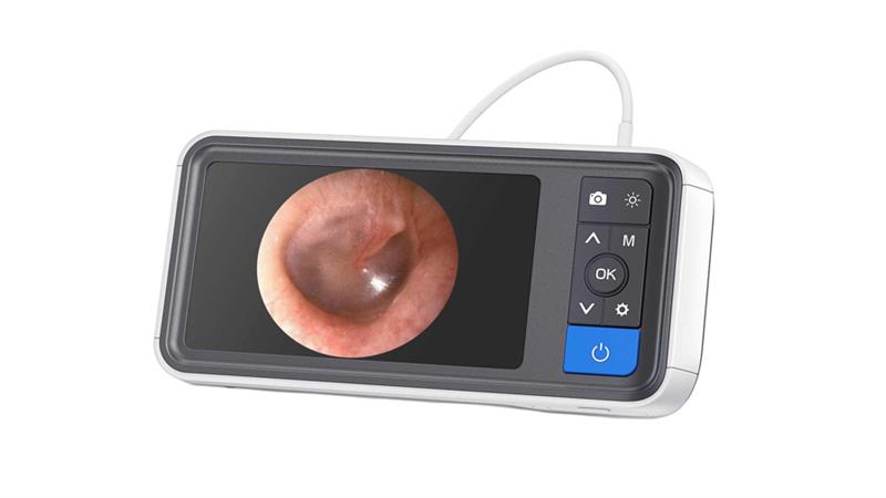 Teslong MS450-NTE Digital Otoscope | MS450-NTE – Endoscopy Superstore