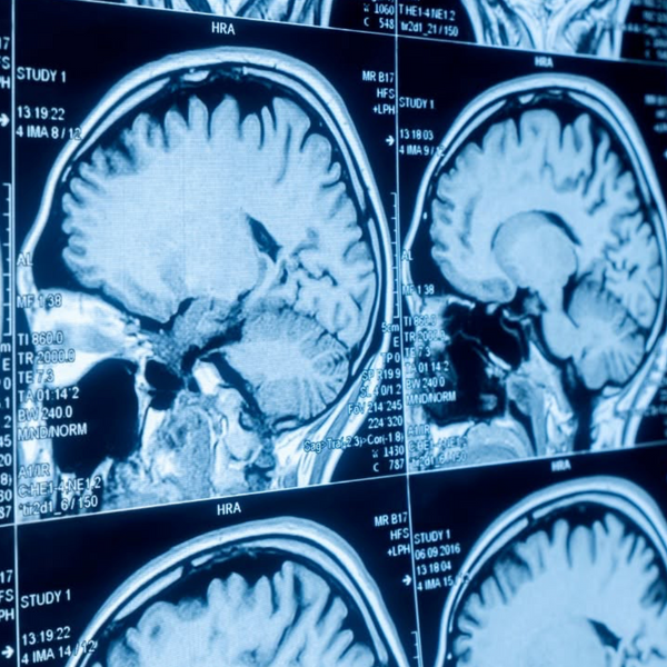 Future of Neurosurgery: Highlights from McMaster University